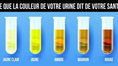 couleur de vos urines